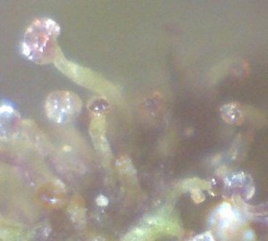 Observation des trichomes grâce au microscope digital