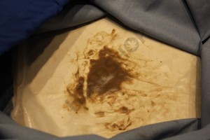 Pensez à bien laisser sécher la résine après l'extraction! Récupération de la résine de cannabis