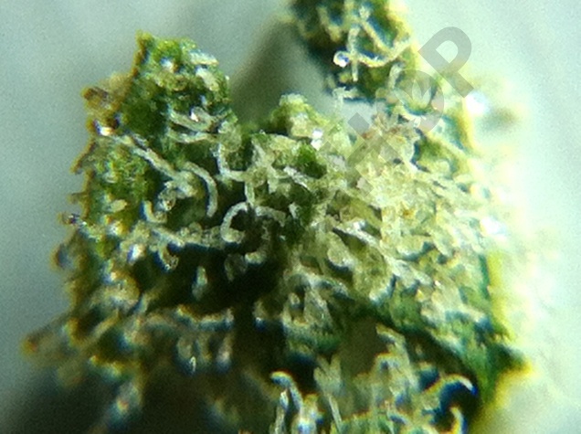 Observation avec un microscope des trichomes mûres